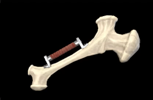 C Bone Hammer S Image
